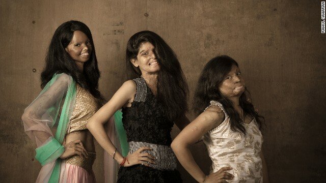 India acid attack survivors pose for ‘ground breaking’ photo shoot-CNN